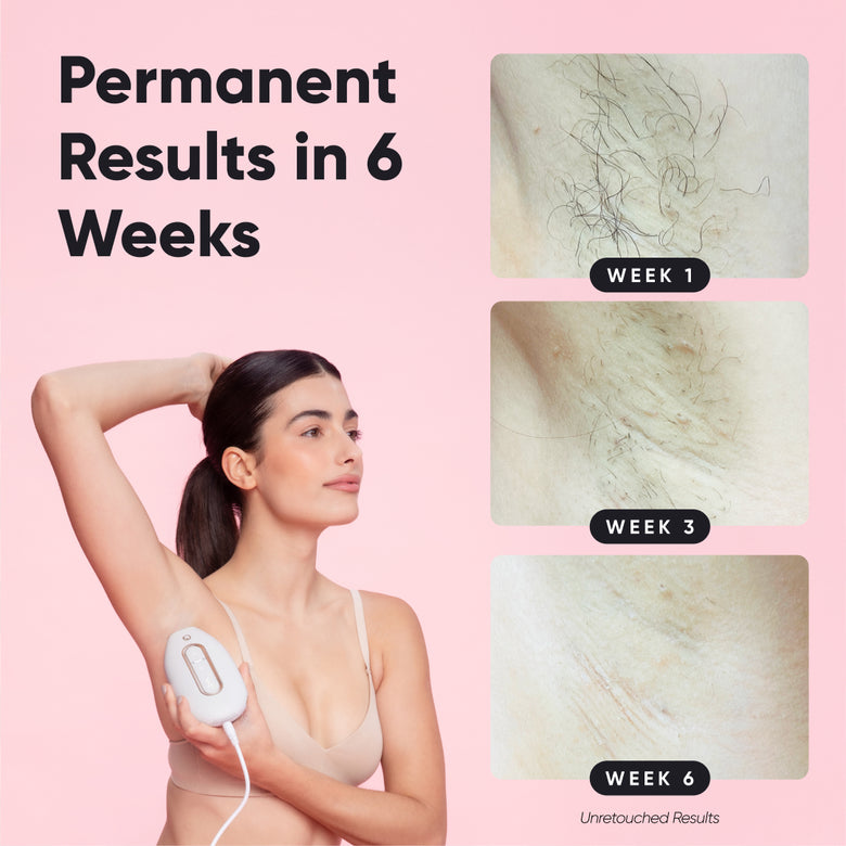 Lumi 2 - The #1 Permanent Hair Removal Device